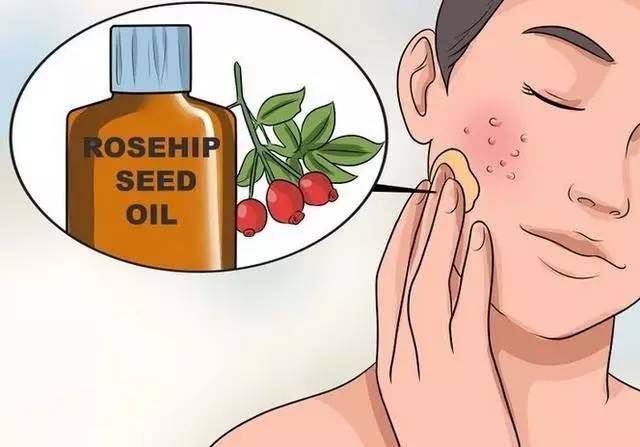 毛孔粗大怎么办教你快速收缩毛孔,毛孔粗大怎么才能有效地收缩毛孔