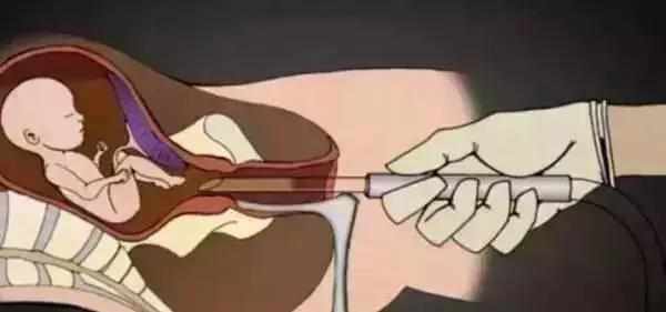 女人这事做多了,想再怀孕生子都是不可能的事情,珍惜身体才是好