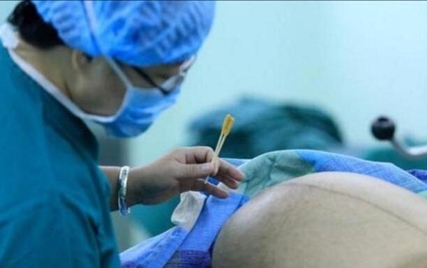 百分之90的孕妈们不知道,生宝宝前“刮毛”,到底有多重要?