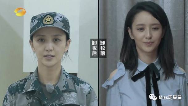 千年黑眼圈解决方案,万年黑眼圈有救的吗