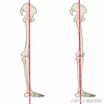 腿肿正确站姿,腿粗是因为胖还是以为腿型不好