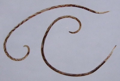 不小心吃了福寿螺怎么办,吃到福寿螺头晕恶心怎么办