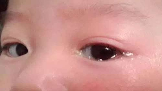 眼屎是身体在自愈吗,眼屎里到底含有什么