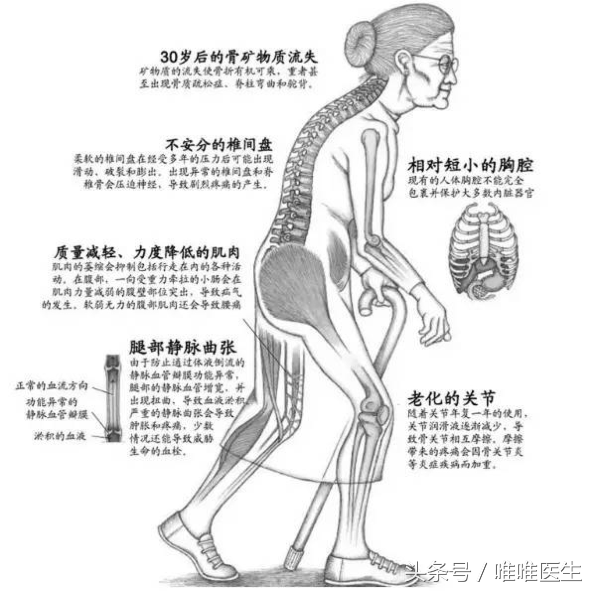 关爱中老年人骨骼健康,关爱中老年人健康知识