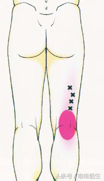 绝对干货膝盖损伤知识一网打尽,膝关节疼痛知识科普