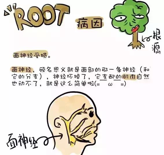 面瘫这个病是什么原因引起的,面瘫病是什么