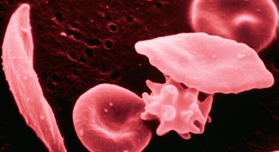 身上长小红点不痛不痒变成黑点,身上长红点像红色小痣怎么回事