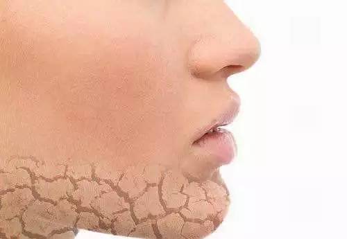 护肤避雷第一步学会辨别自己肤质,护肤第一步如何正确认清自己肤质