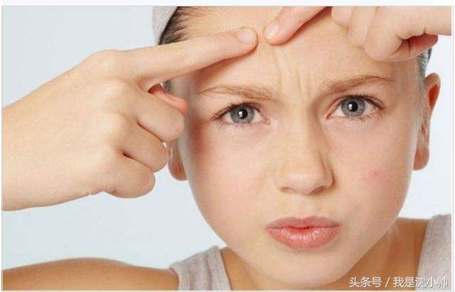 如何祛痘痘印的小窍门简单有效,如何快速祛痘祛痘印小妙招