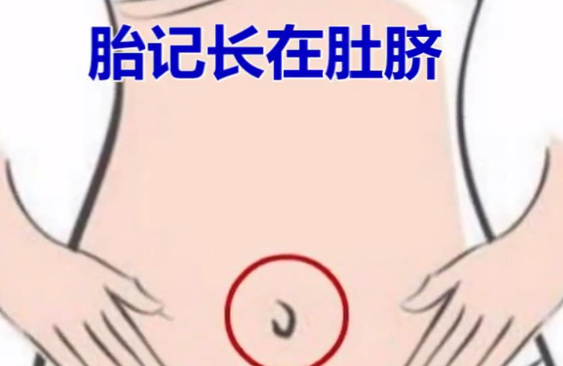 有这几个胎记的，男人出人头地，女人富贵一生，嫁入豪门！你有么