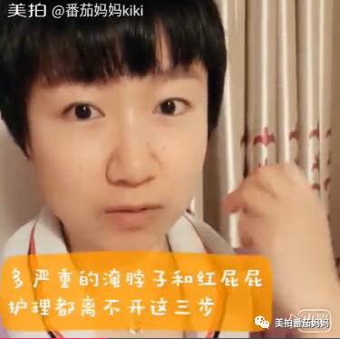 婴儿淹脖子发红怎么处理,宝宝淹脖子和红屁屁用什么产品