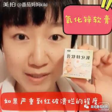 婴儿淹脖子发红怎么处理,宝宝淹脖子和红屁屁用什么产品