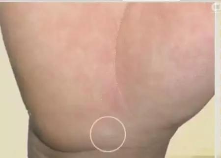 手是人体的重要器官,手的颜色能看出健康的问题吗