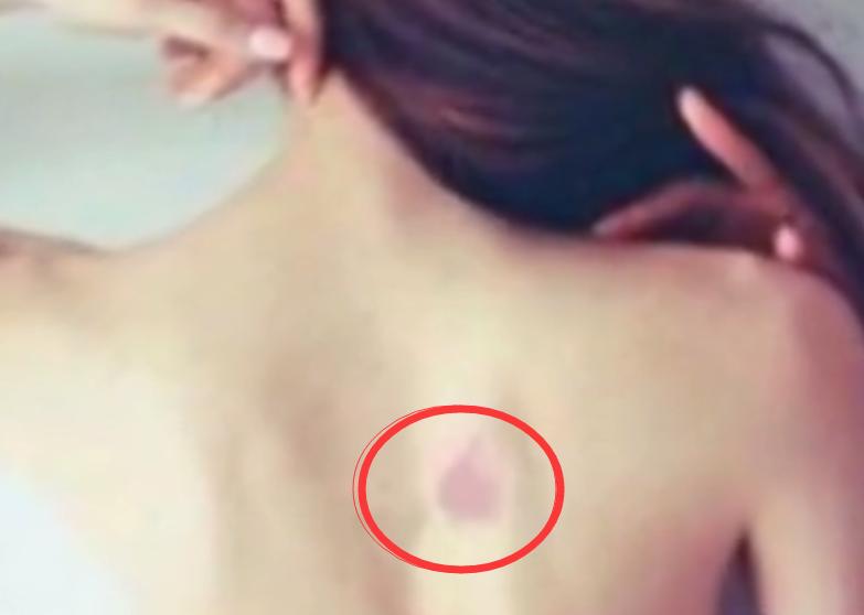 有这几个胎记的，男人出人头地，女人富贵一生，嫁入豪门！你有么