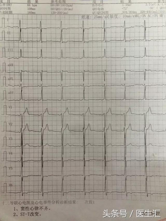 25岁能得心脏病吗,20岁就得了心衰