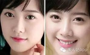 分不清是哪种黑眼圈,分不清楚是眼袋还是黑眼圈