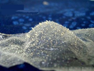 黑头怎么去6招让你远离黑头痛苦