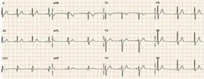 急诊科的困难,急诊科医生吃东西呕吐