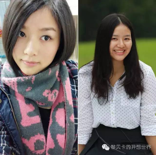 她们说||那些年整牙吞下的血和泪,终于换来最开怀的大笑