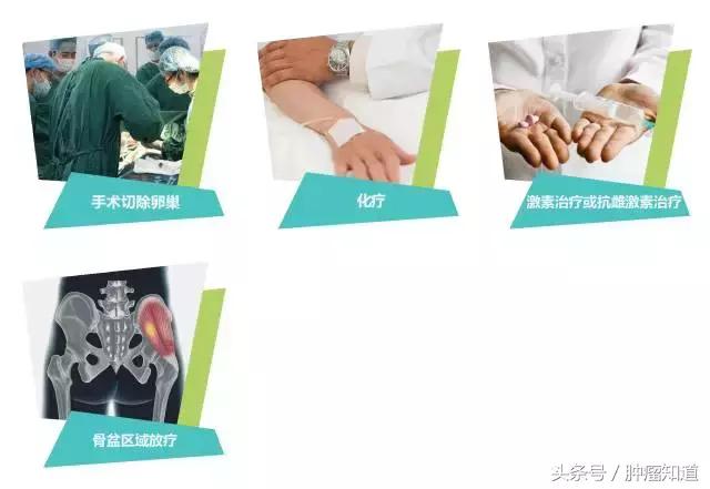 女性更年期症状挂什么科,女性更年期症状抑郁