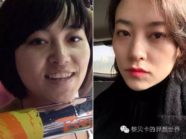 她们说||那些年整牙吞下的血和泪,终于换来最开怀的大笑