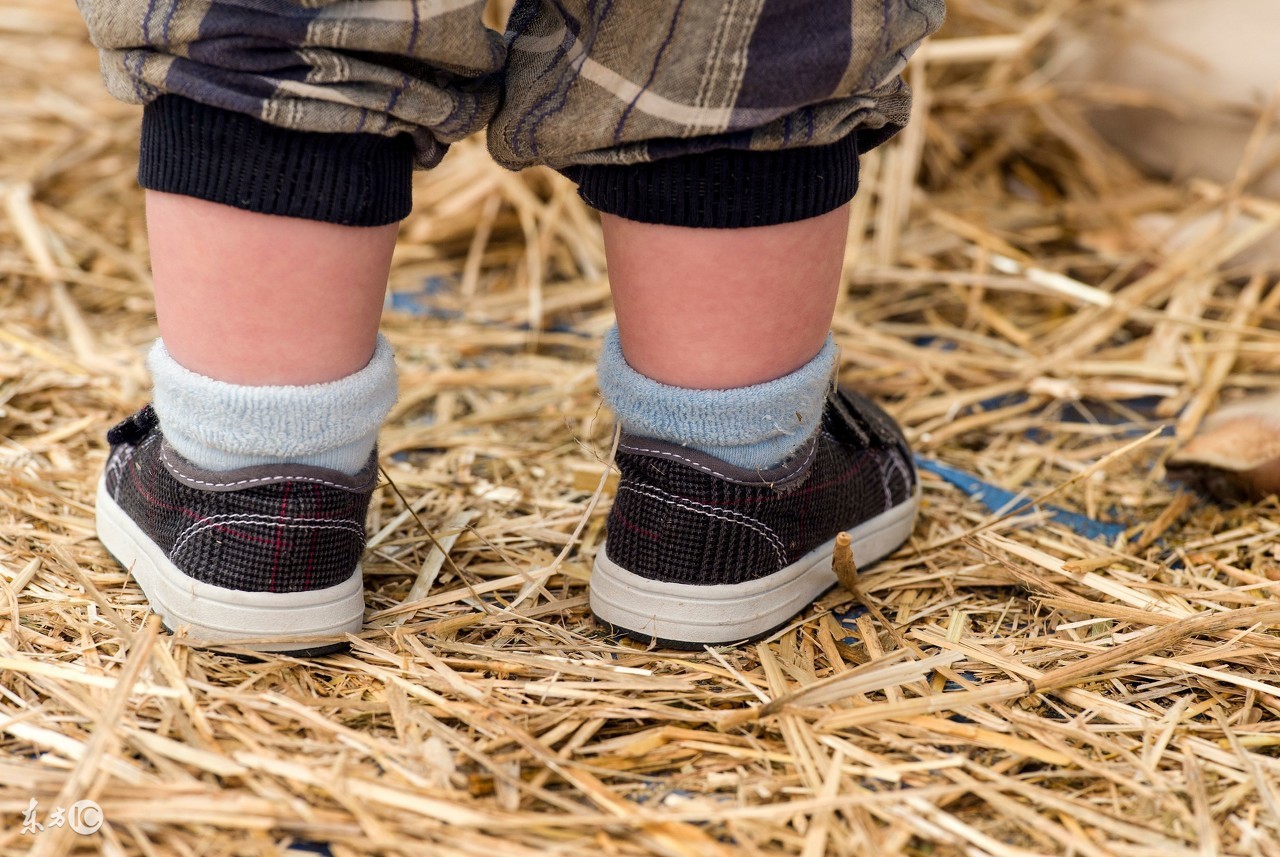 下雨天怎么防止脚水肿,香港脚要如何预防