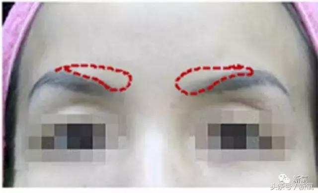 杨紫微整前后容颜对比,杨紫瘦了吗