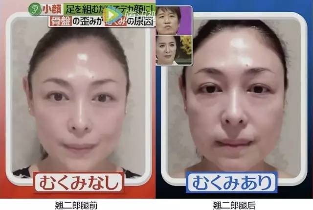 什么坏习惯会让脸更大,什么坏习惯会让脸越来越大