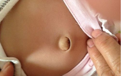 宝宝肚脐眼鼓用硬币怎么弄,看宝宝有没有肠胀气