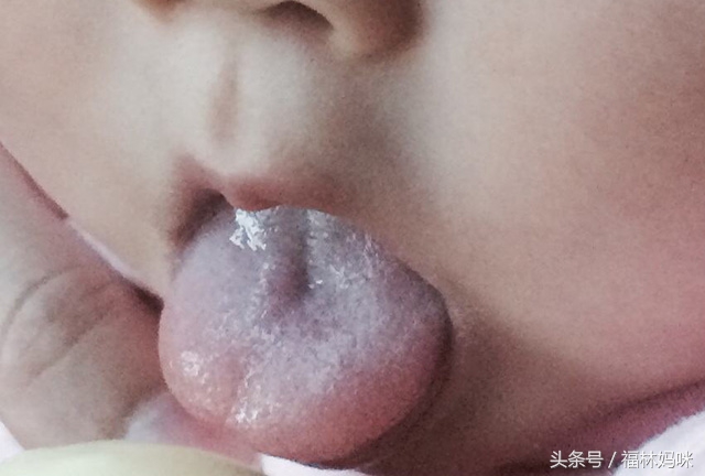 4个月宝宝脾胃不好有什么表现,七个月宝宝脾胃不好的表现和症状