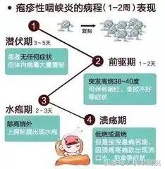 小儿疱疹性咽峡炎用什么中药贴敷,儿科孙丽萍