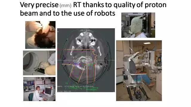 「演讲PPT」法国居里研究所PierreBey:颅底肿瘤的质子放疗