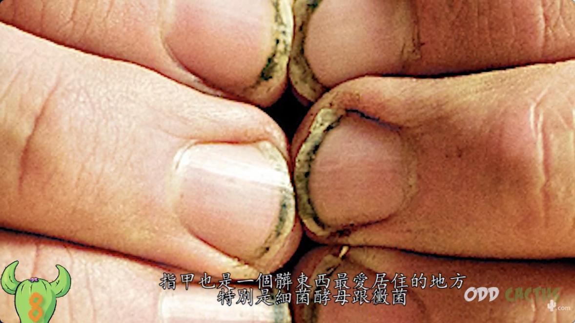 人体最脏的部位对身体的好处,人体最脏的十大部位是哪