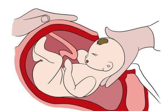 为什么产妇不能选择剖腹产,产妇宫缩疼痛受不了想剖腹产