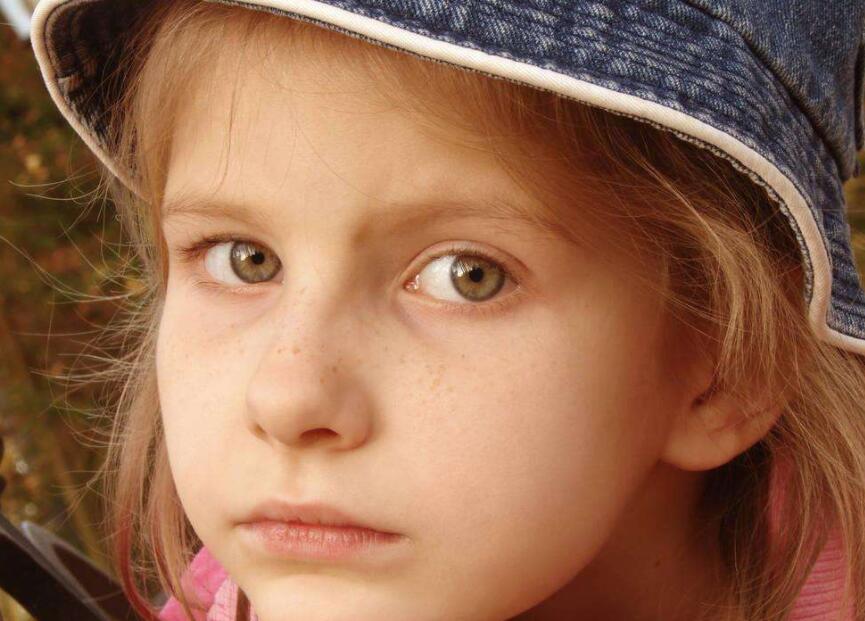 鼻梁两侧黑色素像斑怎么回事,鼻梁黑色素沉淀有什么偏方去除