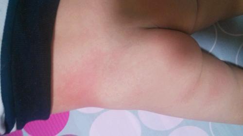 家长说孩子身上有痱子,奶奶一直认为宝宝什么都不知道