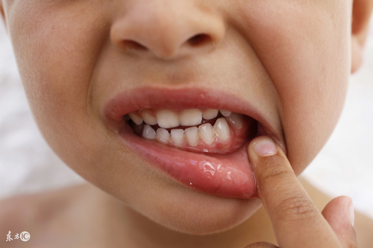 长痘痘上火熬夜口臭喝什么,孕妇上火口臭可以吃什么清热去火