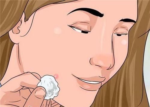 青春痘和普通痘痘有什么区别,什么样的痘痘才是青春痘