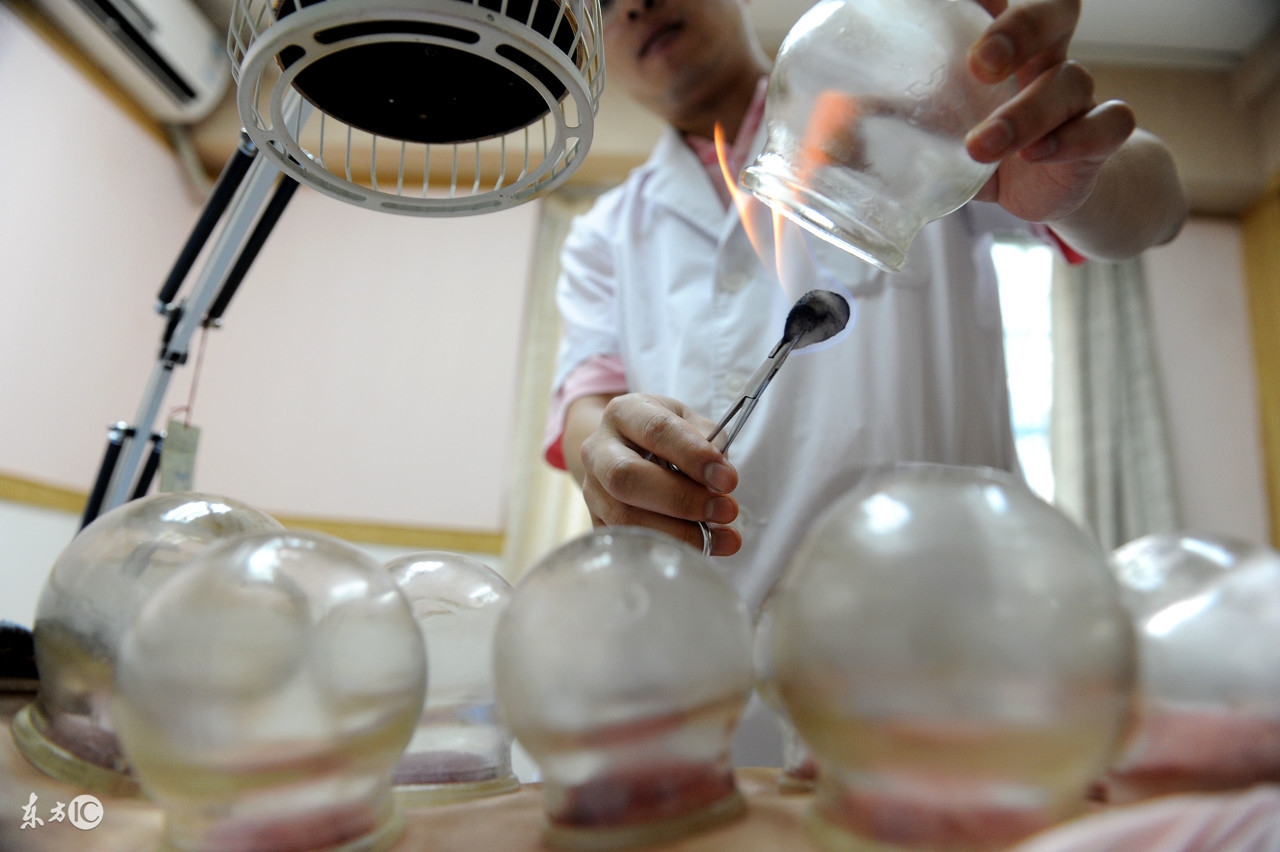 拔罐可以祛除体内湿气吗,拔罐祛除体内湿气位置图