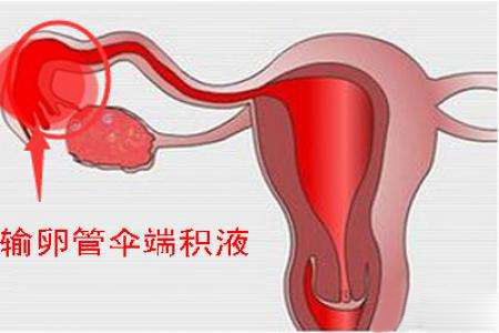 你听到我的心声了是什么意思,输卵管独白