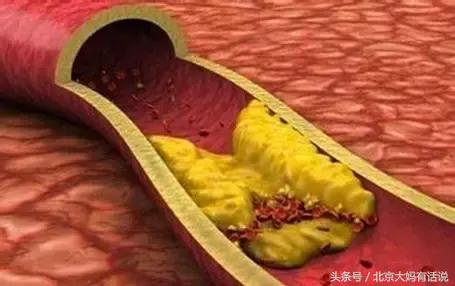 脑动脉硬化白发,白发增多的饮食调理