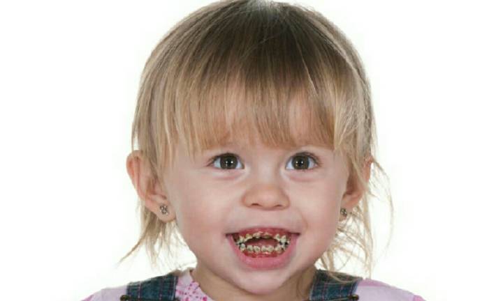 宝宝多久戒奶瓶不会造成龅牙,婴儿一直喝奶瓶一定会变成龅牙吗