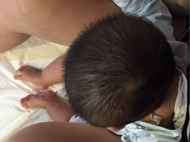 婴儿睡扁头的危害究竟有多大？矫正不及时会变傻子！