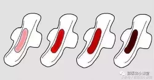 姨妈血黑色是排毒吗,姨妈血发黑