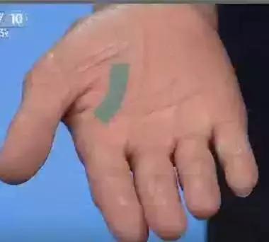 手的颜色能看出健康的问题吗,手是健康的镜子