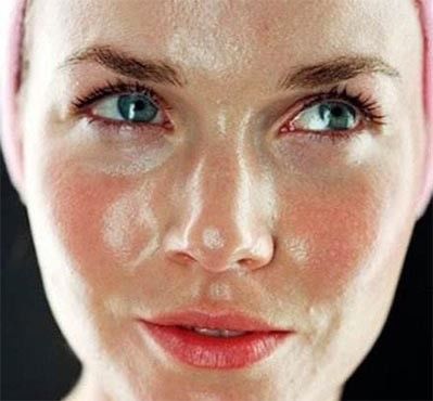 如何快速祛痘消肿鼻头,脸部祛痘小常识