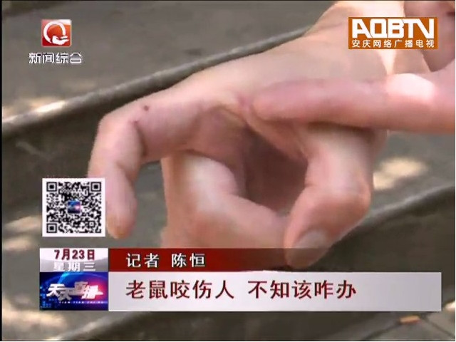 被老鼠咬伤后怎么办,被老鼠咬出血要不要打狂犬病疫苗