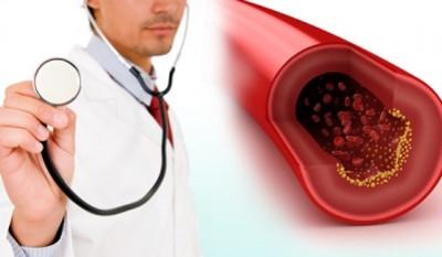 高胆固醇吃什么药,高胆固醇的食物有哪些