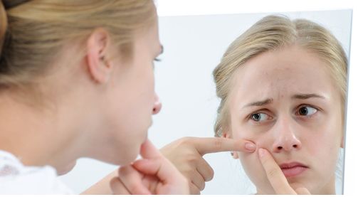 30天祛痘痘最好的方法,抗痘与祛痘的区别