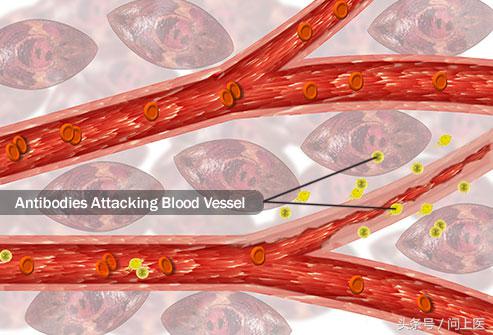 尿液哪个指标可以看出肾功能异常,尿液异常原因有哪些